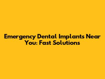 Emergency Dental Implants Near You: Fast Solutions
