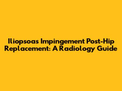 Iliopsoas Impingement Post-Hip Replacement: A Radiology Guide