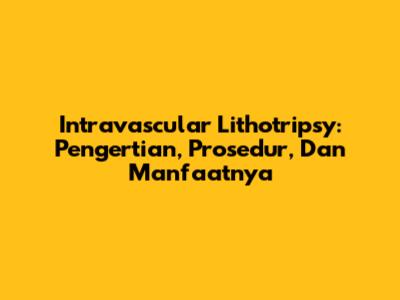 Intravascular Lithotripsy: Pengertian, Prosedur, Dan Manfaatnya